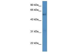 Western Blot showing FAM126A antibody used at a concentration of 1-2 ug/ml to detect its target protein. (FAM126A anticorps  (C-Term))