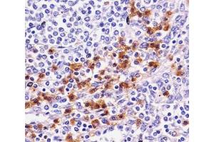 IHC testing of FFPE human speen with CD11b antibody.