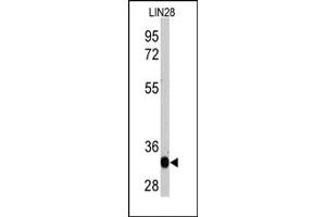 Western Blotting (WB) image for anti-Lin-28 Homolog A (C. Elegans) (LIN28A) antibody (ABIN356385) (LIN28A anticorps)