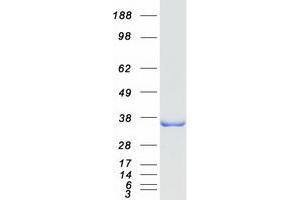 Validation with Western Blot