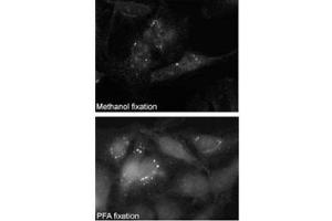 Immunofluorescence staining of p62 antibody on Methanol-fixed and PFA fixed HeLa cells.