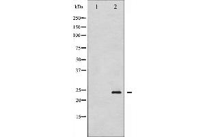 Western blot analysis of Caveolin-1 phosphorylation expression in H2O2 treated NIH-3T3 whole cell lysates,The lane on the left is treated with the antigen-specific peptide.