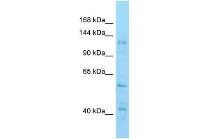 WB Suggested Anti-Hdac6 Antibody   Titration: 1. (HDAC6 anticorps  (C-Term))