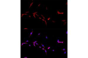 Immunofluorescence analysis of PC-12 cells using CD40L antibody (ABIN6133614, ABIN6138190, ABIN6138191 and ABIN6216826) at dilution of 1:100. (CD40 Ligand anticorps  (AA 79-129))