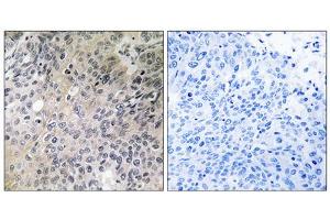Immunohistochemistry analysis of paraffin-embedded human lung tissue using SHC3 antibody.