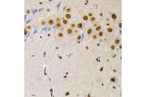 Immunohistochemistry of paraffin-embedded rat brain using HNRNPA1 Antibody (ABIN5975570) at dilution of 1/100 (40x lens). (HNRNPA1 anticorps)