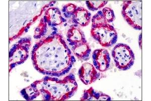 Immunohistochemistry (IHC) image for anti-Integrin beta 4 (ITGB4) antibody (ABIN614431) (Integrin beta 4 anticorps)