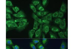 Immunofluorescence analysis of U-2 OS cells using EIF3D Polyclonal Antibody at dilution of 1:100. (EIF3D anticorps)