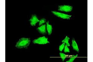 Immunofluorescence of monoclonal antibody to MKNK1 on HeLa cell. (MKNK1 anticorps  (AA 1-465))