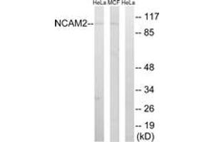 Western blot analysis of extracts from MCF-7/HeLa cells, using NCAM2 Antibody. (NCAM2 anticorps  (AA 264-313))