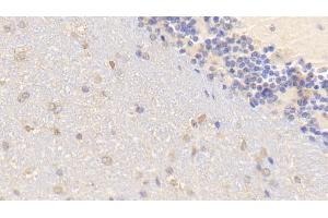 Detection of BMP2 in Mouse Cerebellum Tissue using Polyclonal Antibody to Bone Morphogenetic Protein 2 (BMP2)