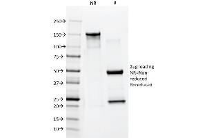 SDS-PAGE Analysis Purified Cytokeratin 10 Mouse Monoclonal Antibody (AE20).