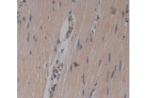 IHC-P analysis of Kidney tissue, with DAB staining. (Junctophilin 1 anticorps  (AA 1-201))