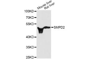 Western blot analysis of extracts of various cell lines, using SMPD2 antibody (ABIN1874877) at 1:3000 dilution. (SMPD2 anticorps)