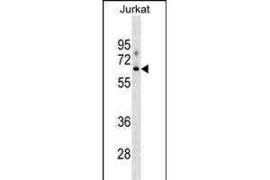 XYLB Antibody (N-term) (ABIN1539119 and ABIN2849290) western blot analysis in Jurkat cell line lysates (35 μg/lane). (XYLB anticorps  (N-Term))