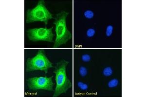 Immunofluorescence staining of fixed HeLa cells with anti-NFKB2 antibody SAIC-26C-15.