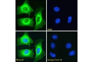 Immunofluorescence staining of fixed HeLa cells with anti-NFKB2 antibody SAIC-26C-15. (Recombinant NFKB2 anticorps)