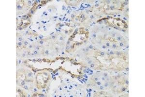 Immunohistochemistry of paraffin-embedded Rat kidney using B9D1 Polyclonal Antibody at dilution of 1:100 (40x lens).