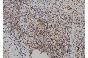 ABIN6273574 at 1/100 staining Human spleen tissue by IHC-P.