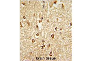 Formalin-fixed and paraffin-embedded human brain tissue reacted with DLX2 Antibody , which was peroxidase-conjugated to the secondary antibody, followed by DAB staining.