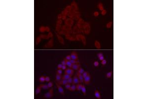 Immunofluorescence analysis of HeLa cells using PDE10A Rabbit pAb (ABIN7269297) at dilution of 1:25 (40x lens).