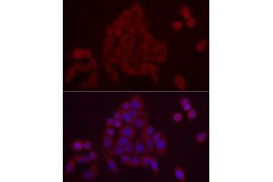 Immunofluorescence analysis of HeLa cells using PDE10A Rabbit pAb (ABIN7269297) at dilution of 1:25 (40x lens). (PDE10A anticorps  (AA 23-200))