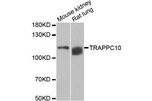 Western blot analysis of extracts of various cell lines, using TRAPPC10 antibody. (TRAPPC10 anticorps)