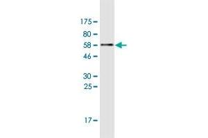 Western Blot detection against Immunogen (57. (XPA anticorps  (AA 1-273))