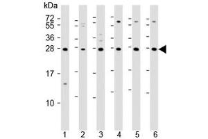 Western blot testing of 1) mouse EL4, human 2) fetal thymus, 3) spleen, 4) HUT78, 5) Jurkat and 6) Molt-4 lysate with TIGIT antibody. (TIGIT anticorps  (AA 12-142))