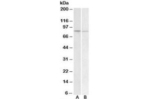 Western blot testing of human peripheral blood lymphocyte [A] and human spleen [B] lysate with BACH1 antibody at 1ug/ml. (BACH1 anticorps)