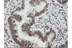 Image no. 7 for anti-Zinc Finger and SCAN Domain Containing 18 (ZSCAN18) antibody (ABIN1501857) (ZSCAN18 anticorps)