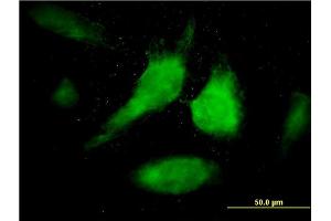 Immunofluorescence of monoclonal antibody to STAT1 on HeLa cell.