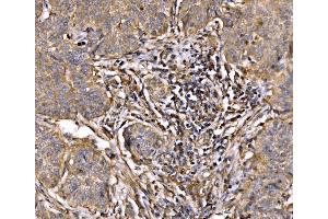 IHC analysis of PI 3 Kinase p85 alpha/PIK3R1 using anti-PI 3 Kinase p85 alpha/PIK3R1 antibody (ABIN7599781). (PIK3R1 anticorps  (AA 117-153))