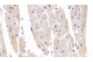 Detection of PDGFB in Porcine Cardiac Muscle Tissue using Polyclonal Antibody to Platelet Derived Growth Factor Subunit B (PDGFB)