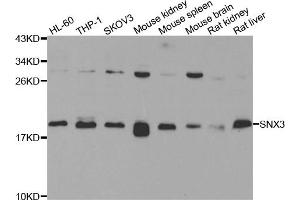 Western blot analysis of extracts of various cell lines, using SNX3 antibody. (Sorting Nexin 3 anticorps)