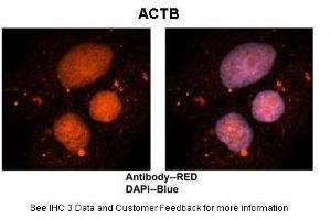 Sample Type :  Human brain stem cells  Primary Antibody Dilution :  1:500  Secondary Antibody :  Goat anti-rabbit Alexa-Fluor 594  Secondary Antibody Dilution :  1:1000  Color/Signal Descriptions :  ACTB: Red DAPI:Blue  Gene Name :  ACTB  Submitted by :  Dr.