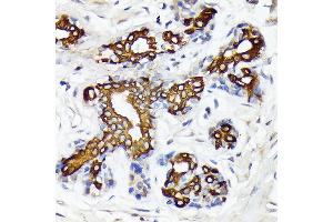 Immunohistochemistry of paraffin-embedded human breast using CYP26 Rabbit mAb (ABIN7266654) at dilution of 1:100 (40x lens).
