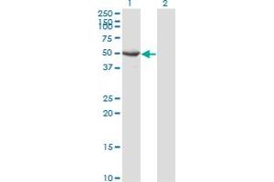 Western Blot analysis of SEPT10 expression in transfected 293T cell line by SEPT10 monoclonal antibody (M02), clone 3A9. (Septin 10 anticorps  (AA 1-454))