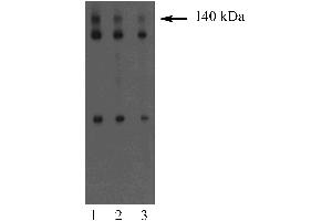 Western blot analysis of Dlg on an A431 cell lysate (Human epithelial carcinoma, ATCC CRL-1555). (DLG1 anticorps  (AA 5-213))