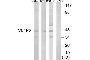 Western blot analysis of extracts from COLO cells, HUVEC cells and MCF-7 cells, using VN1R2 antibody.