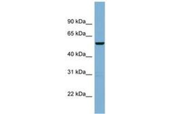 CNOT11 anticorps  (AA 215-264)
