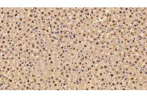 Detection of TKT in Rat Liver Tissue using Polyclonal Antibody to Transketolase (TKT)