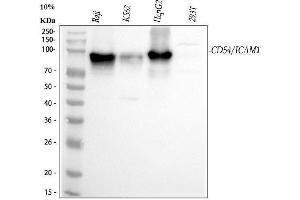 Western blot analysis of ICAM1 using anti-ICAM1 antibody (ABIN5692991). (ICAM1 anticorps  (AA 28-268))