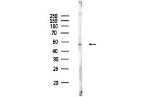 Western blot analysis of lysates from COLO205 cells(heat-shock,45 min treatment), using Phospho-FAS (Tyr291) Antibody at 1/1000 dilution.
