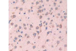 Used in DAB staining on fromalin fixed paraffin- embedded brain tissue