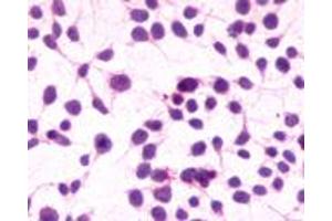 Anti-CNR1 / CB1 antibody immunocytochemistry (ICC) staining of untransfected HEK293 human embryonic kidney cells.