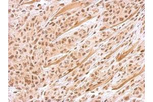 IHC-P Image FANCJ antibody [N1N2], N-term detects BRIP1 protein at nucleus on SAS xenograft by immunohistochemical analysis.