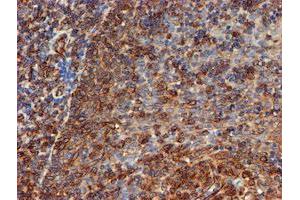 Image no. 6 for anti-Sec1 Family Domain Containing 1 (SCFD1) antibody (ABIN1500819)