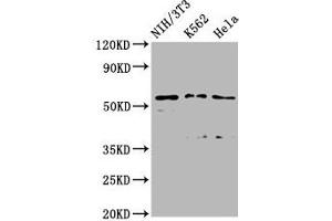 Western Blot Positive WB detected in: NIH/3T3 whole cell lysate, K562 whole cell lysate, Hela whole cell lysate All lanes: TTC26 antibody at 2. (TTC26 anticorps  (AA 5-122))