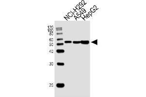 Lane 1: NCI-H292 Cell lysates, Lane 2: A549 Cell lysates, Lane 3: HepG2 Cell lysates, probed with ALDH2 (138CT22. (ALDH2 anticorps)